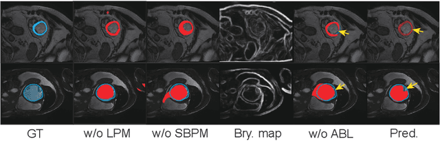 Figure 4 for Scribble2D5: Weakly-Supervised Volumetric Image Segmentation via Scribble Annotations