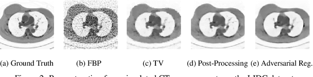 Figure 4 for Adversarial Regularizers in Inverse Problems