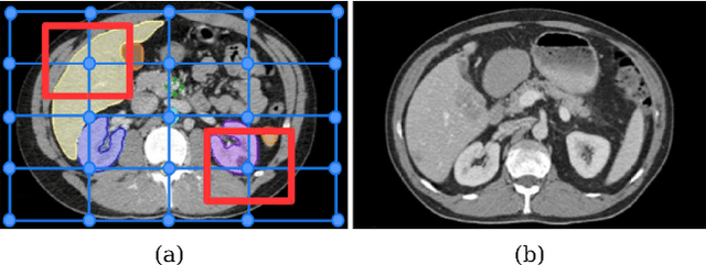 Figure 1 for Weakly-Supervised Learning of Metric Aggregations for Deformable Image Registration