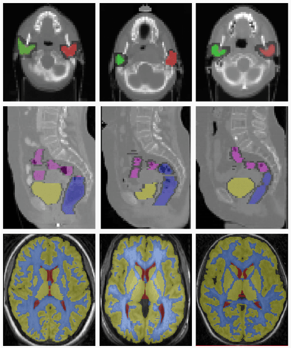Figure 2 for Weakly-Supervised Learning of Metric Aggregations for Deformable Image Registration