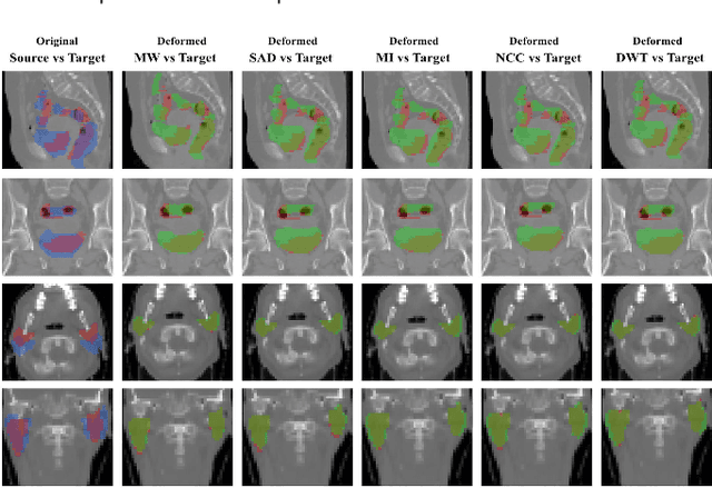 Figure 3 for Weakly-Supervised Learning of Metric Aggregations for Deformable Image Registration