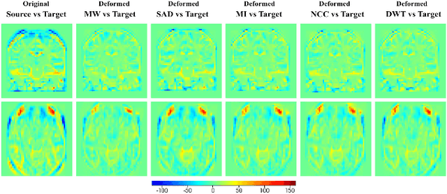 Figure 4 for Weakly-Supervised Learning of Metric Aggregations for Deformable Image Registration