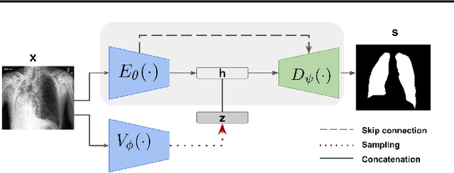Figure 3 for Lung Segmentation from Chest X-rays using Variational Data Imputation