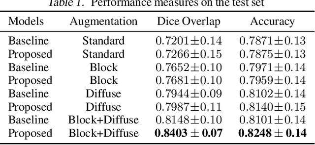 Figure 2 for Lung Segmentation from Chest X-rays using Variational Data Imputation