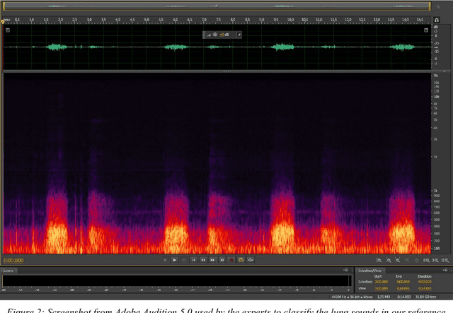 Figure 3 for Feature Extraction for Machine Learning Based Crackle Detection in Lung Sounds from a Health Survey