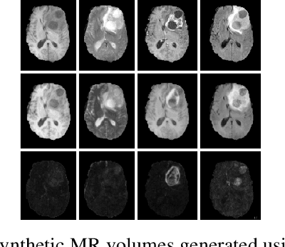 Figure 3 for RS-Net: Regression-Segmentation 3D CNN for Synthesis of Full Resolution Missing Brain MRI in the Presence of Tumours