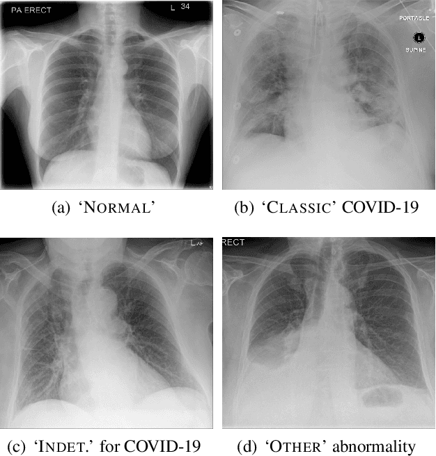 Figure 1 for Hierarchical Analysis of Visual COVID-19 Features from Chest Radiographs