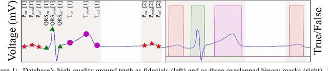 Figure 1 for ECG-DelNet: Delineation of Ambulatory Electrocardiograms with Mixed Quality Labeling Using Neural Networks