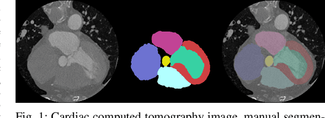 Figure 1 for Cardiac Segmentation on CT Images through Shape-Aware Contour Attentions