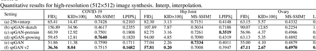 Figure 4 for Sketch guided and progressive growing GAN for realistic and editable ultrasound image synthesis