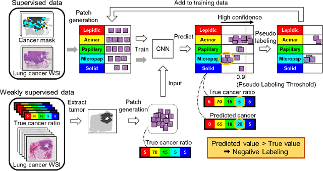 Figure 1 for Negative Pseudo Labeling using Class Proportion for Semantic Segmentation in Pathology