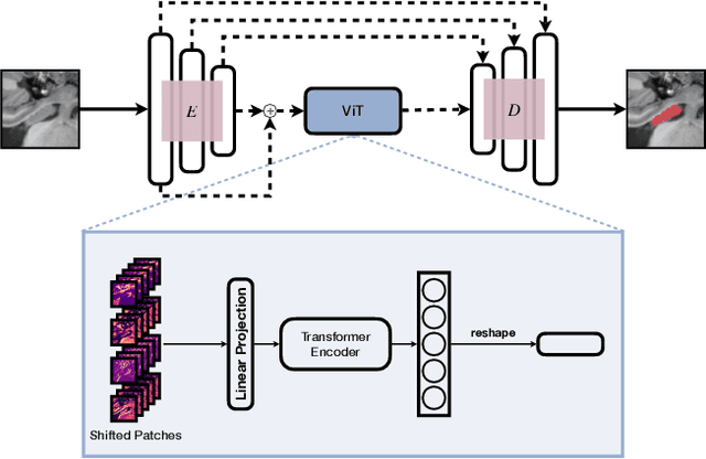 Figure 2 for Continual Hippocampus Segmentation with Transformers
