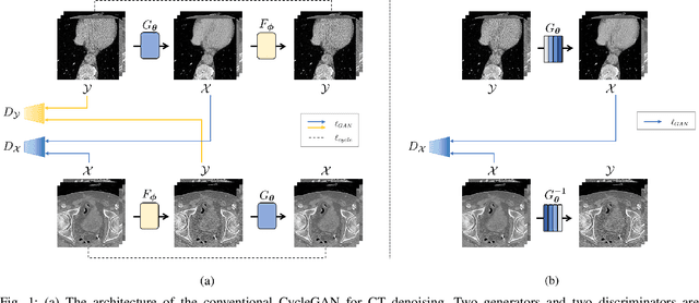 Figure 1 for Cycle-free CycleGAN using Invertible Generator for Unsupervised Low-Dose CT Denoising