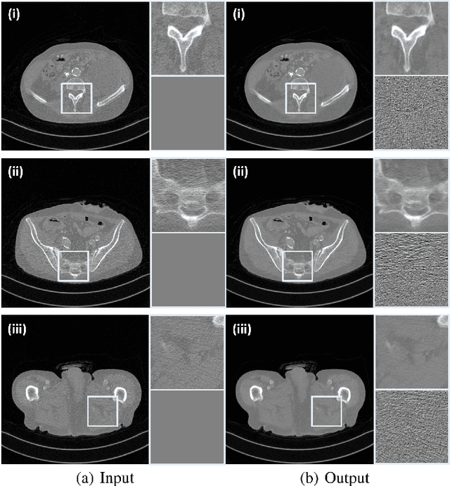 Figure 2 for Cycle-free CycleGAN using Invertible Generator for Unsupervised Low-Dose CT Denoising