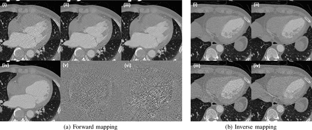 Figure 3 for Cycle-free CycleGAN using Invertible Generator for Unsupervised Low-Dose CT Denoising