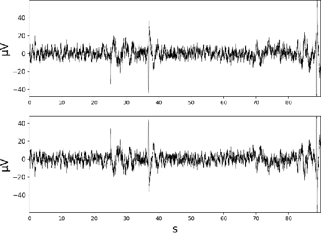 Figure 2 for DeepSleepNet-Lite: A Simplified Automatic Sleep Stage Scoring Model with Uncertainty Estimates