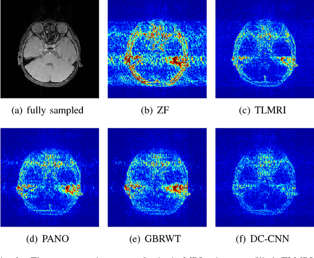 Figure 2 for A Deep Error Correction Network for Compressed Sensing MRI