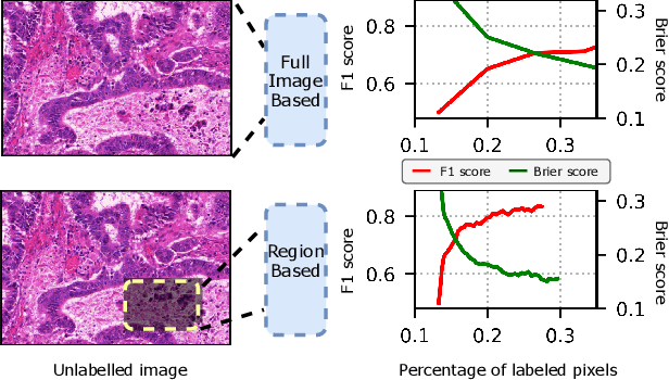 Figure 1 for On uncertainty estimation in active learning for image segmentation