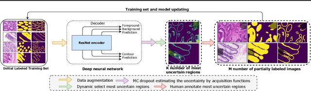 Figure 3 for On uncertainty estimation in active learning for image segmentation