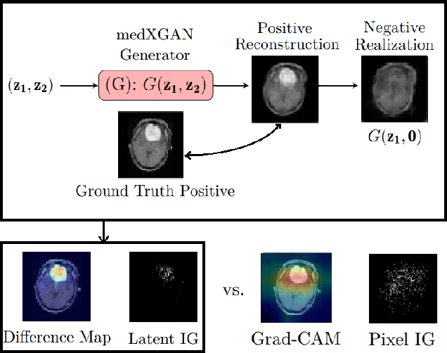 Figure 1 for medXGAN: Visual Explanations for Medical Classifiers through a Generative Latent Space