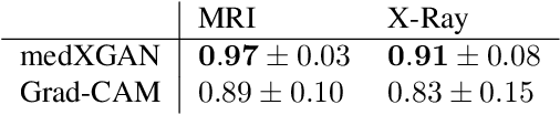 Figure 4 for medXGAN: Visual Explanations for Medical Classifiers through a Generative Latent Space