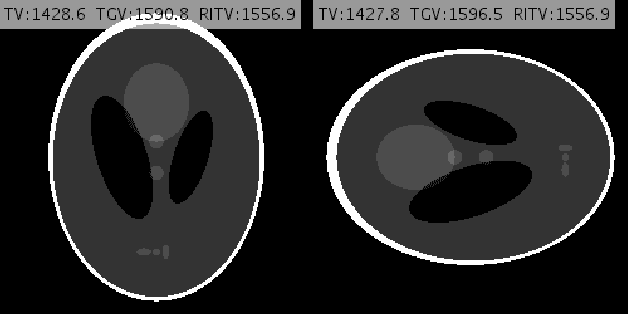 Figure 1 for Compressed MRI Reconstruction Exploiting a Rotation-Invariant Total Variation Discretization