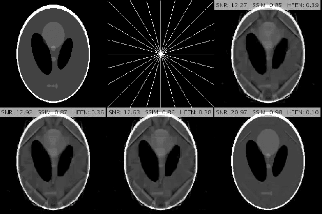 Figure 3 for Compressed MRI Reconstruction Exploiting a Rotation-Invariant Total Variation Discretization