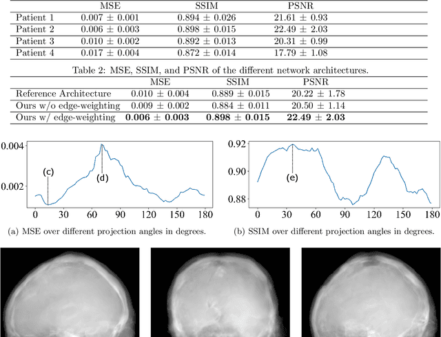 Figure 2 for Projection image-to-image translation in hybrid X-ray/MR imaging