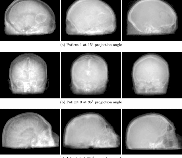 Figure 4 for Projection image-to-image translation in hybrid X-ray/MR imaging