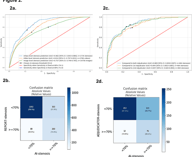 Figure 2 for CathAI: Fully Automated Interpretation of Coronary Angiograms Using Neural Networks