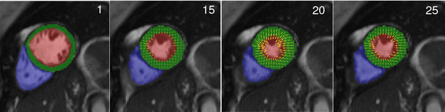 Figure 4 for Joint Learning of Motion Estimation and Segmentation for Cardiac MR Image Sequences