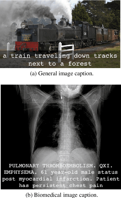 Figure 1 for A Survey on Biomedical Image Captioning