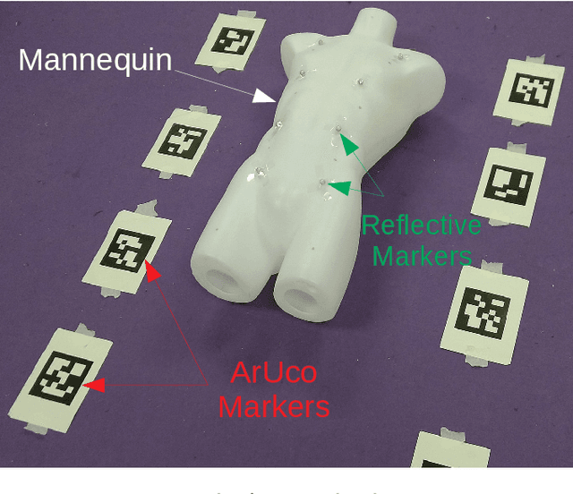 Figure 4 for 3D Reconstruction and Alignment by Consumer RGB-D Sensors and Fiducial Planar Markers for Patient Positioning in Radiation Therapy