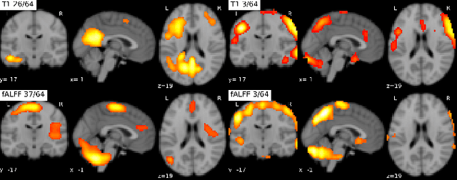 Figure 3 for On self-supervised multi-modal representation learning: An application to Alzheimer's disease