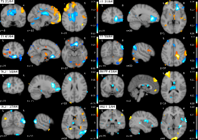 Figure 4 for On self-supervised multi-modal representation learning: An application to Alzheimer's disease
