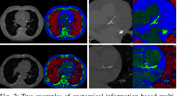 Figure 2 for Knowledge-based Analysis for Mortality Prediction from CT Images