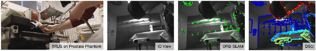 Figure 2 for Markerless Inside-Out Tracking for Interventional Applications