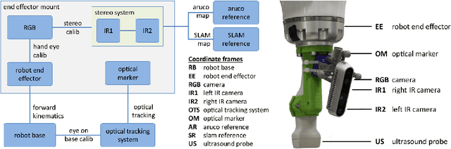 Figure 3 for Markerless Inside-Out Tracking for Interventional Applications