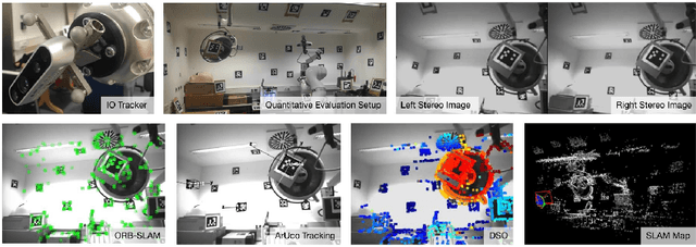 Figure 4 for Markerless Inside-Out Tracking for Interventional Applications