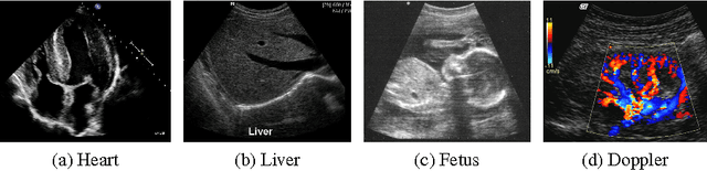 Figure 1 for The Ultrasound Visualization Pipeline - A Survey