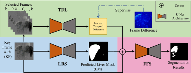 Figure 3 for Hepatocellular Carcinoma Segmentation fromDigital Subtraction Angiography Videos usingLearnable Temporal Difference