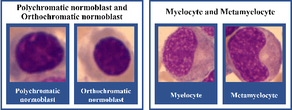 Figure 3 for Bone Marrow Cell Recognition: Training Deep Object Detection with A New Loss Function