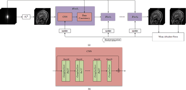 Figure 1 for DeepcomplexMRI: Exploiting deep residual network for fast parallel MR imaging with complex convolution