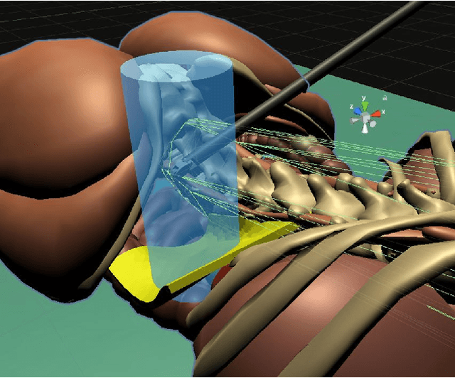 Figure 2 for Safe Reinforcement Learning using Formal Verification for Tissue Retraction in Autonomous Robotic-Assisted Surgery