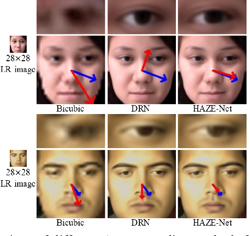 Figure 2 for HAZE-Net: High-Frequency Attentive Super-Resolved Gaze Estimation in Low-Resolution Face Images