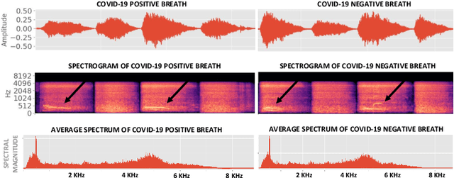 Figure 2 for Machine Learning based COVID-19 Detection from Smartphone Recordings: Cough, Breath and Speech