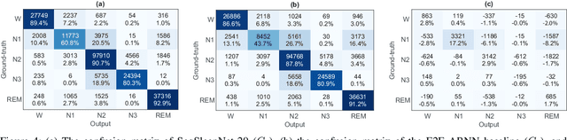 Figure 4 for SeqSleepNet: End-to-End Hierarchical Recurrent Neural Network for Sequence-to-Sequence Automatic Sleep Staging