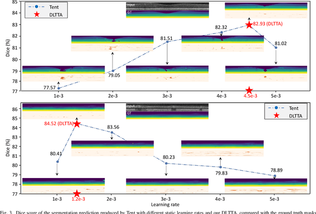 Figure 3 for DLTTA: Dynamic Learning Rate for Test-time Adaptation on Cross-domain Medical Images