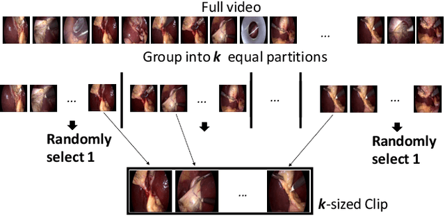 Figure 1 for Federated Cycling (FedCy): Semi-supervised Federated Learning of Surgical Phases