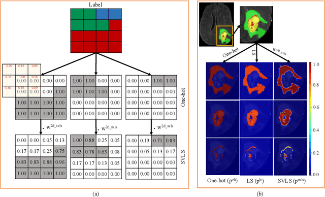 Figure 1 for Spatially Varying Label Smoothing: Capturing Uncertainty from Expert Annotations